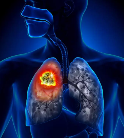 �ΰ�����֢״