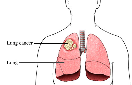 �ΰ������ܻ���