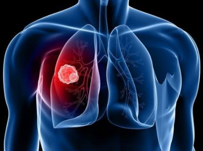 �ΰ������ܻ���