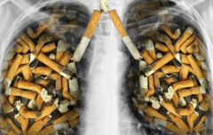 ������������Ҳ�п����Ƿΰ�������֢״