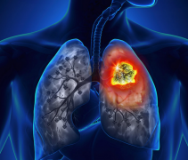 ����Ŀǰ����Сϸ���ΰ���SCLC������Ҫ�����ֶ�