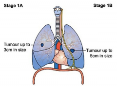�ΰ����߼����ΰ����ڴ�Ⱦ��