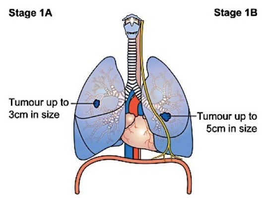 �ΰ����ڴ�Ⱦ��