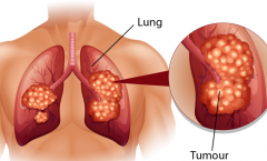 �չ˷ΰ����˲����·ΰ����ڴ�Ⱦ��