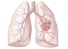 �ΰ���ת�ƵĻ����Ʒ��Ƿ�������