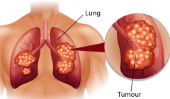 �����Է�Сϸ���ΰ����Ƶİ���ҩ���й�����