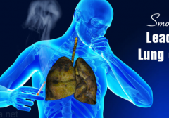 ʹ�ð���ҩ���Ƶķΰ����κ���