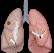 ����˻�������Եķΰ�������ǰ֢״