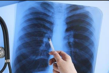 �ΰ��������ö���