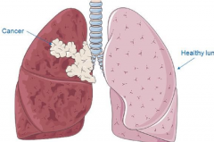 ���ڷΰ����˳�ʲô�ô��ڵ�һЩ����