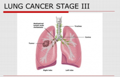 �˽�ΰ����ڵ�֢״�����ڰ������߼���ʹ��