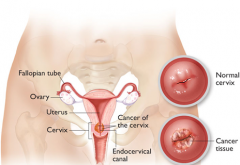 ����������ٰ�֢״��Ҫע��