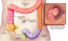 ����Ѫ����������ֱ����֢״����