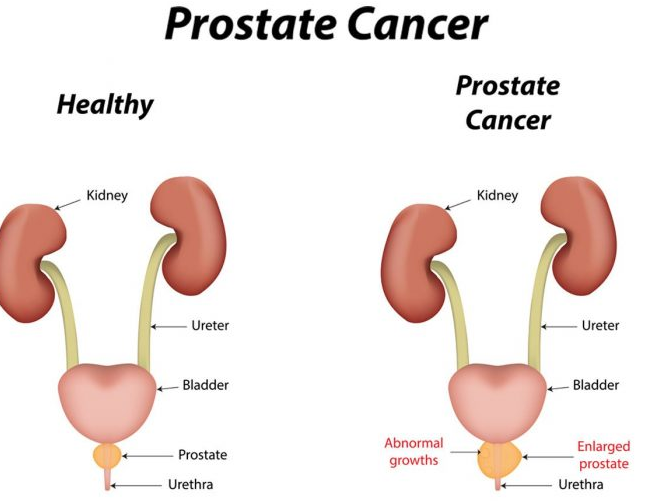 ǰ���ٰ�֢״