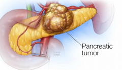 �����������ֵĲ�λ��ͬ���ٰ�֢״Ҳ��ͬ