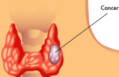 ���ڼ�״�ٰ�֢״���ֲ�����