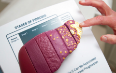 �ճ��Ӵ��ᵼ�±��δ�Ⱦ��