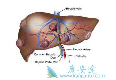 1522295451122158.png blob.png