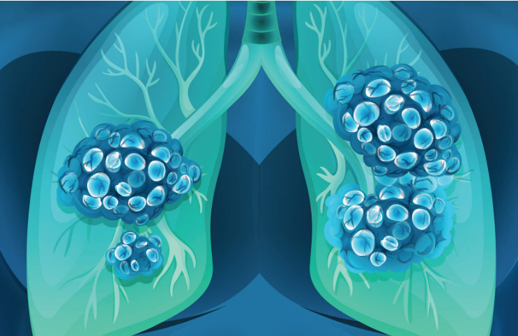 1522300251967913.png blob.png