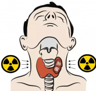 ��״�ٰ�֢��������������������ԭ��