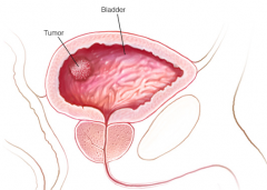 ��Ƶ����ʹ�����������ڰ��װ�֢״