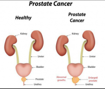 �о�����ǰ���ٰ�֢�뷼�㰷��������������ع�ϵ