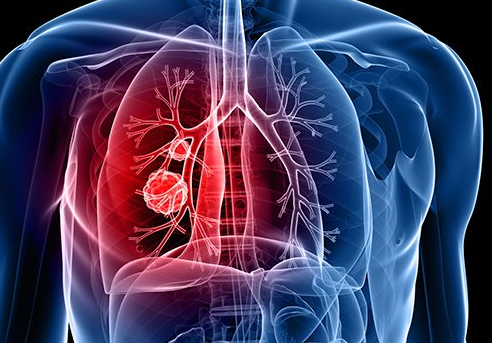 �ΰ���ת��