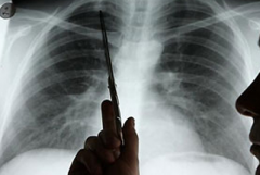 ���ڷΰ���ת��֢״������