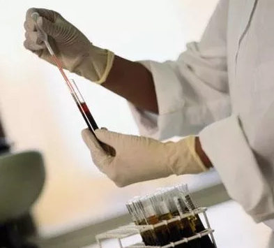 乙肝检测 乙肝检测