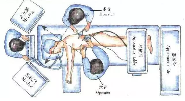 ��Сϸ���ΰ�