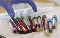 Kite��Sangamo��ɺ�������ͨ����CAR-T�з�