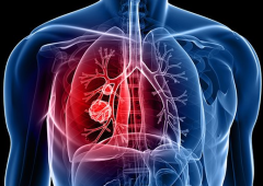 ALKͻ��ΰ�������ҩ������Щ