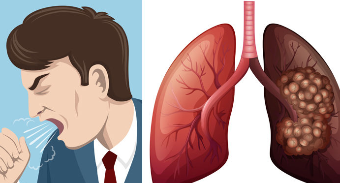 �ΰ�������ʲô֢״