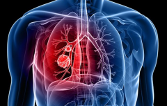 ���Ի��Ʒ����Ƿΰ���������Ʒ���