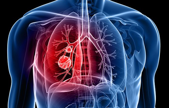 �ΰ���������Ʒ���