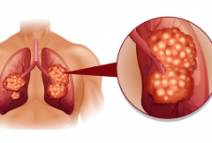 �����ΰ����ڻ��ܻ���