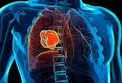 ���߷�չ���˷ΰ�������ô���ƱȽϺ�