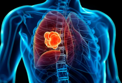 ��Էΰ���ת�Ƶ����Ƶ���ҩ����Щ