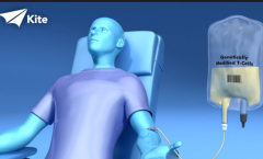 CAR-T�Ʒ���ʵ������Ч����ô��