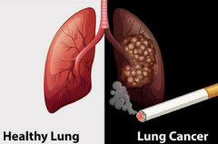 ��Сϸ���ΰ�������֢״�������������ص�ʹ��