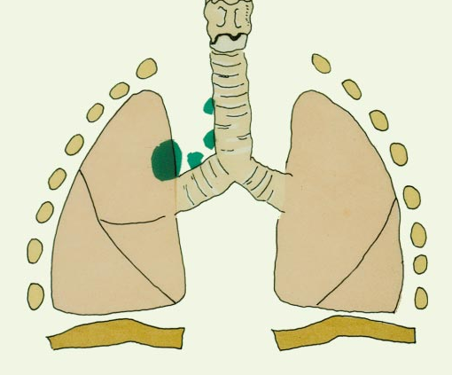 �ΰ���ת��