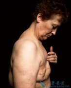 ��֢�����Ѵ�ҹ�ע�������ٰ�֢״