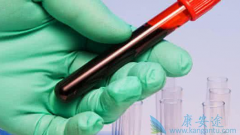 �ܰͰ�֢״�Լ�Ҫ���Ԥ����֢�ķ���