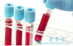 �й���֢��ͼ�г�����֢������֢״