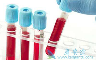 1522747319105255.png blob.png