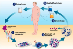 CAR-Tϸ�������Ʒ��������ٴ���ȡ���˳־õ��ٴ���Ч