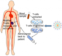 CAR-Tϸ�������Ʒ�������Щ��������