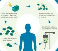 CAR-Tϸ��������ѪҺϵͳ�������кõ��ٴ���Ч