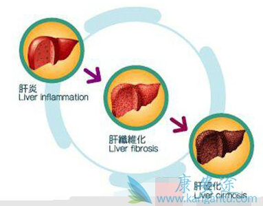 1523176663140412.png blob.png