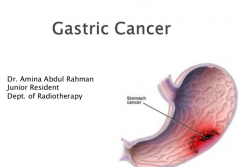 ��鷢���Լ��������Ű�֢״����Щ